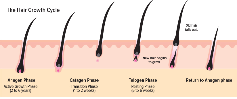 Stages of Alopecia