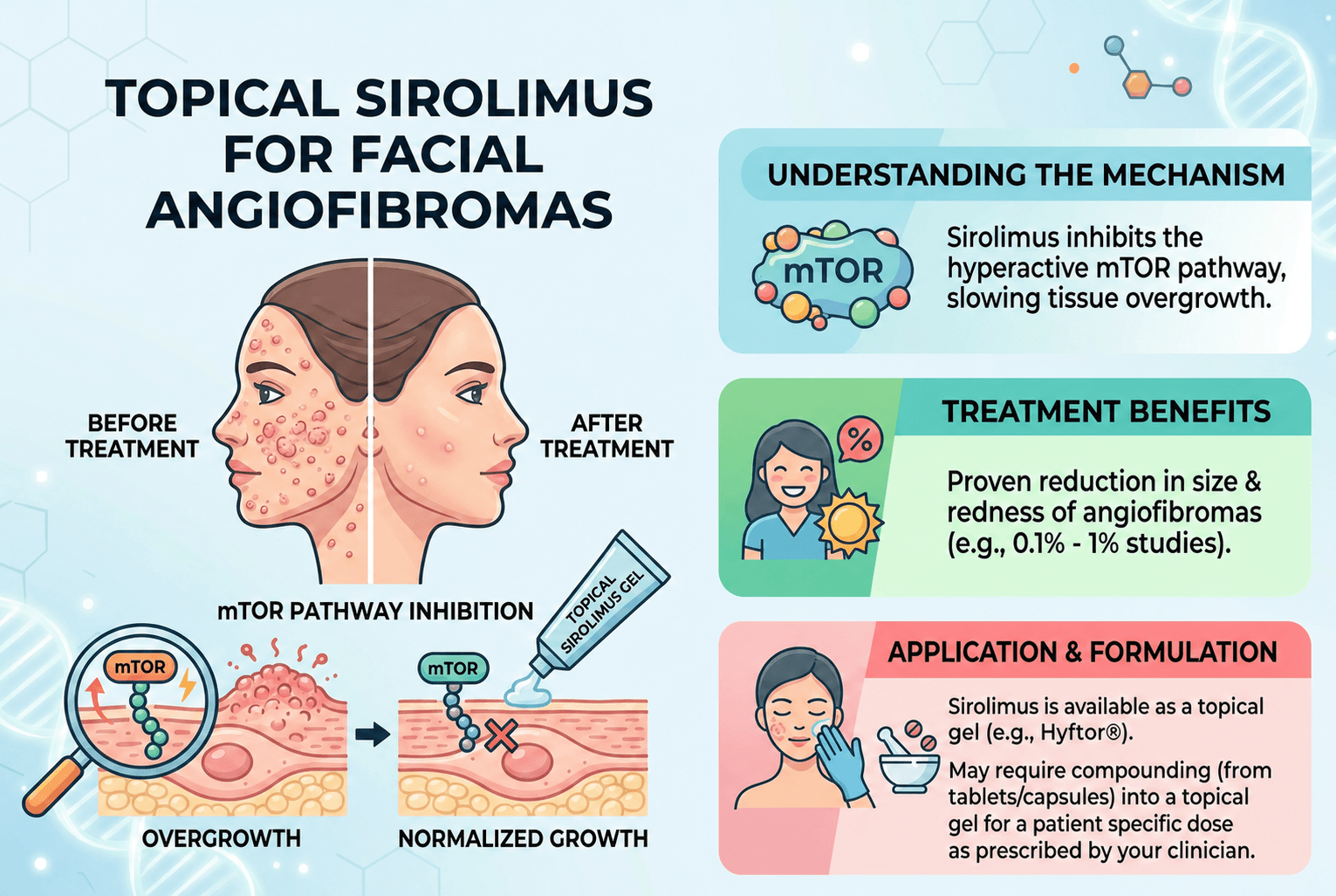 Topical Sirolimus for Facial Angiofibromas