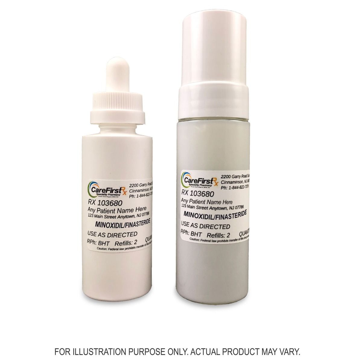 Minoxidil and Minoxidil/Finasteride Compounded